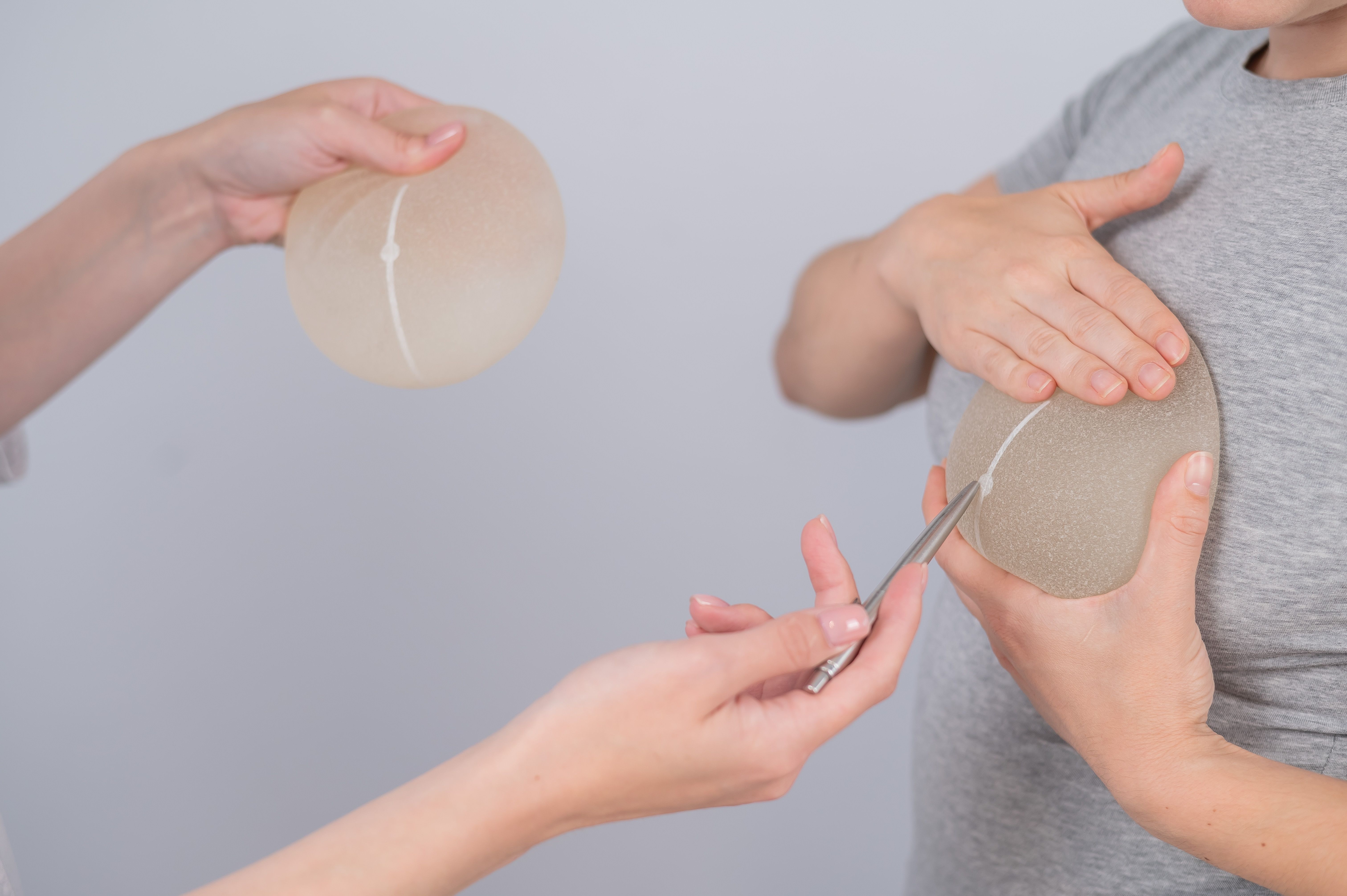 Patientin probiert Probeimplantate aus