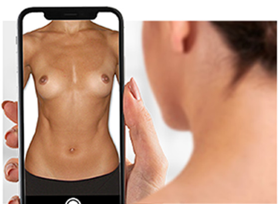 Frau sieht auf ihrem Smartphone ihre Brüste in der Crisalix 3D-Simulation