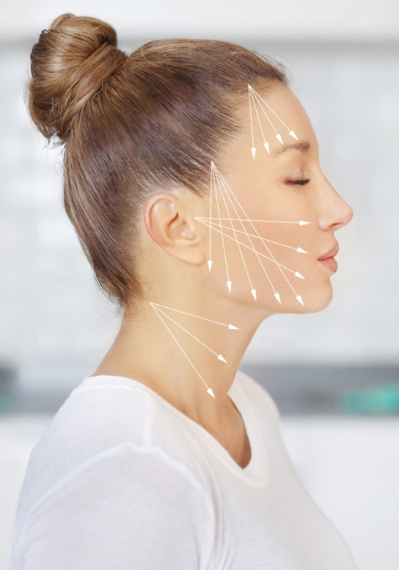 Rechte Gesichtshälfte einer jungen Frau mit eingezeichneten Linien eines Fadenliftings